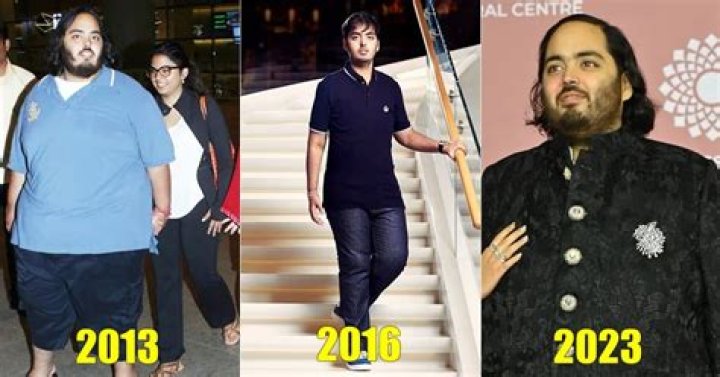 Anant Ambani Health Issues Illness And Weight Loss Journey Celeb Jam