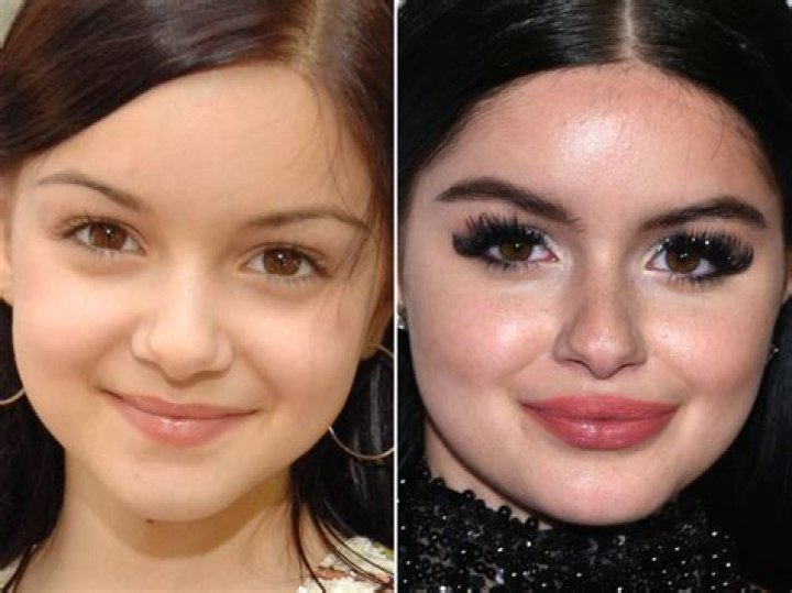 Ariel Winter&rsquo;s Before and After Breast Reduction Photos Show How Happy