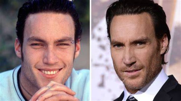Callan Mulvey de Hartley, c&oelig;urs &agrave; vif se confie sur son accident Elle