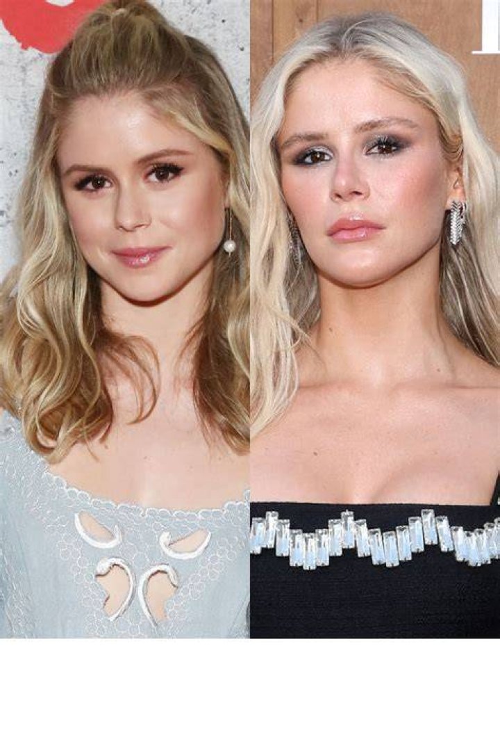 Did Erin Moriarty Get A Nose And Lips Done? Plastic Surgery