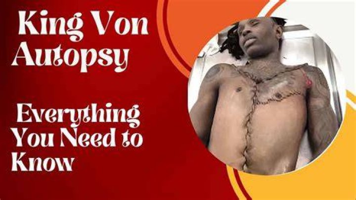 King Von Autopsy Photos Digital Bharat Startup