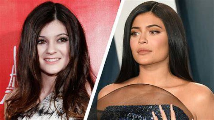 Kylie Jenner before and after her jawdropping transformation pics