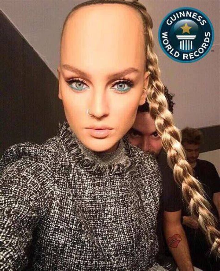 Largest Forehead In The World