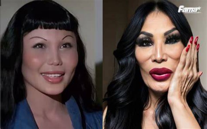 Lyn May Antes y después de presumir su nuevo rostro Telemundo