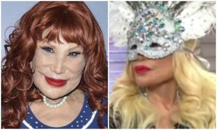Lyn May y su rostro antes de las cirug&iacute;as El Diario NY