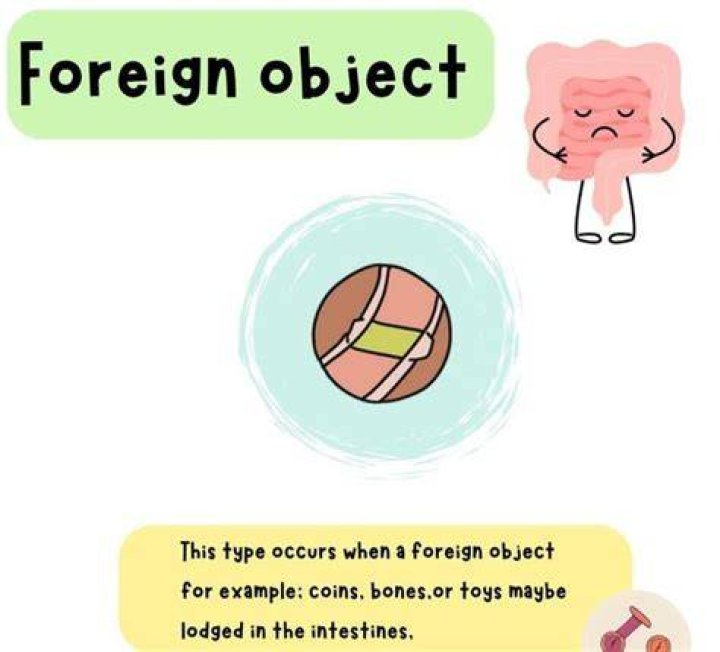 My 123 Cents Foreign Object Friday Rick Martel's Arrogance