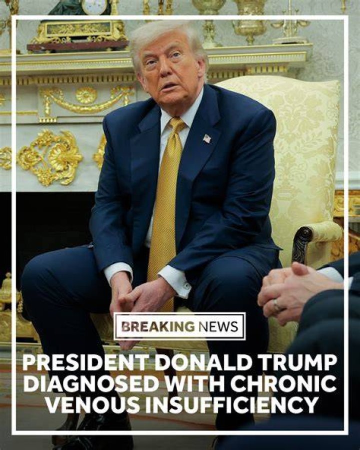 President Trump has mild symptoms, official says