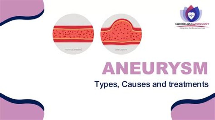 What causes an aneurysm? Jo Lindner cause of death and symptoms