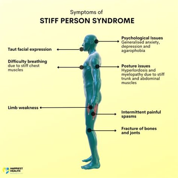 What Is Stiff Person Syndrome? Celine Dion Diagnosed With Rare and
