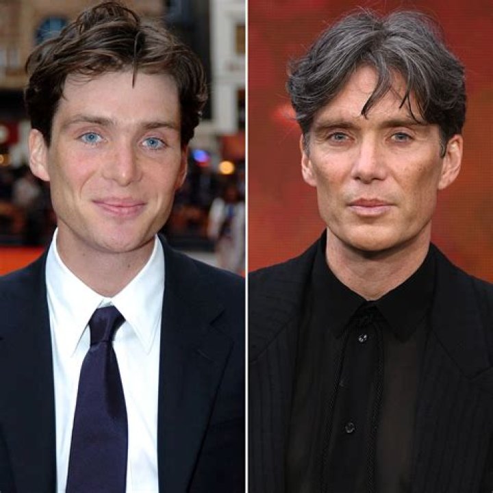 Why Cillian Murphy Has A Lump Behind His Right Ear: The Truth Revealed